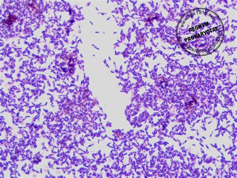 Regnum Prokaryotae Microscope Images