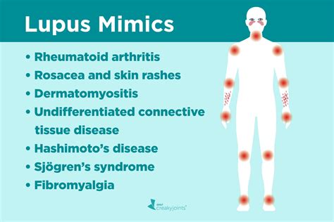 Lupus Misdiagnosis Diseases That Can Mimic Lupus