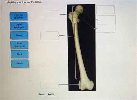 Solved Label The Structures Of The Bone Proximal Epiphysis