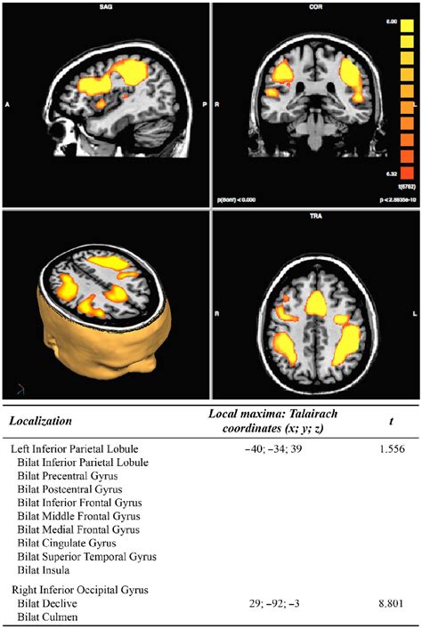 Results Of Pre Treatment Functional Magnetic Resonance Imaging Fmri