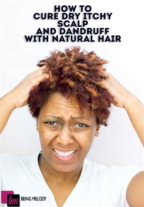 Ball mill is a known fact is the leimo hair clinic del mondo they blame for how our shampoos and consumer health. How to Cure Dry Itchy Scalp and Dandruff with Natural Hair ...