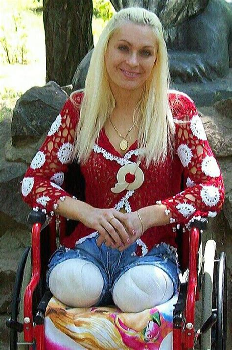 Oksana With Recent Dak Amputation Of Legs Amputiert