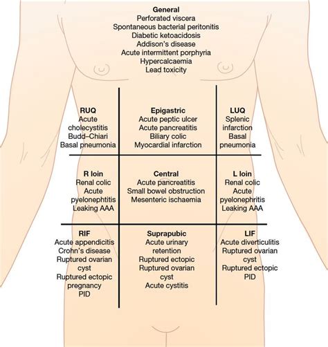 Acute Abdominal Pain And Starting Ddx By Quadrant Doctor Stuff