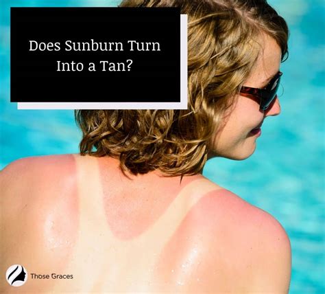 does sunburn turn into a tan everything you need to know