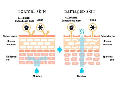 What Is The Skin Barrier And Why You Should Care About It