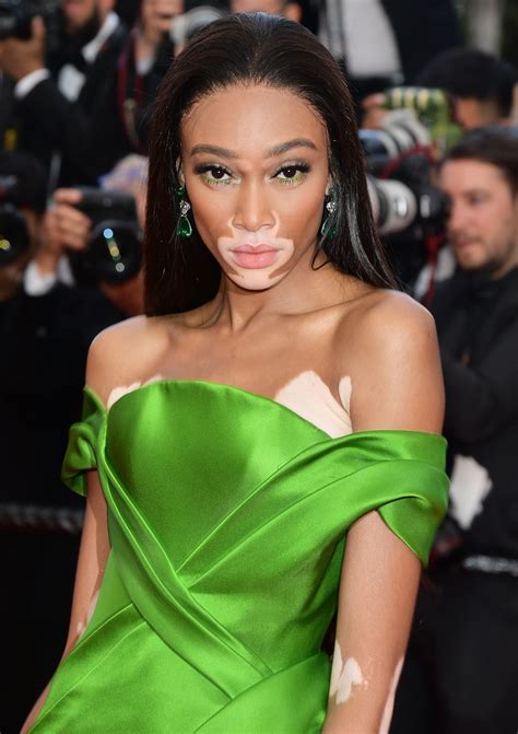 Antm Contestant Winnie Harlow Defends Her Comments About The Show I