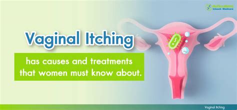 Vaginal Itching Female Genital Itching Causes And Treatments That Girls