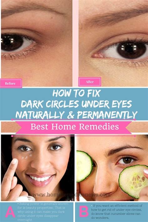 How To Get Rid Of Dark Circle Under Eyes Naturally And Permanently At