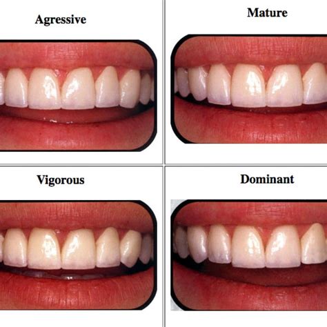 How To Get Perfect Teeth Shape Naturally Unugtp News