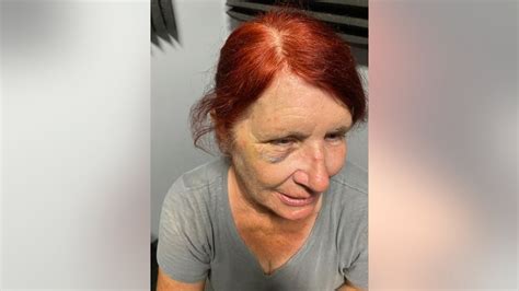 Lowes Rehires Woman Who Was Assaulted Suffered Black Eye While Trying