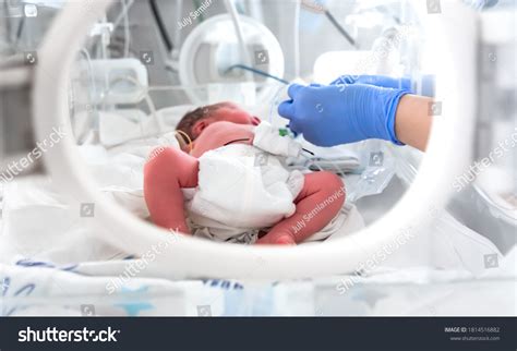 Photo Premature Baby Incubator Focus On库存照片1814516882 Shutterstock
