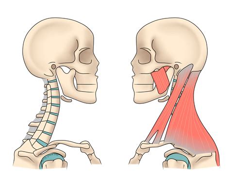 Neck Pain Ilminster Osteopathy