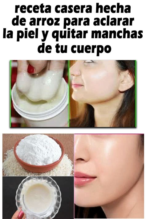 Crema Para Quitar Manchas De La Cara Casera Remedios Caseros Para