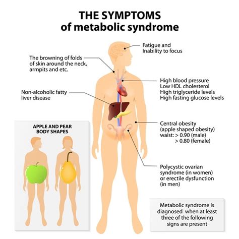 Metabolic Syndrome And Bariatric Surgery