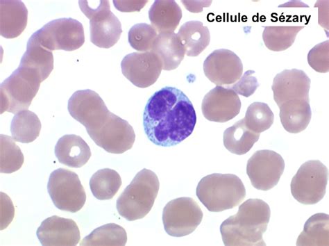 Pathologie Immunitaire