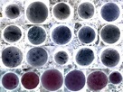مورفولوژی انتاموبا کولی Entamoeba coli morphology | انگل شناسی پزشکی