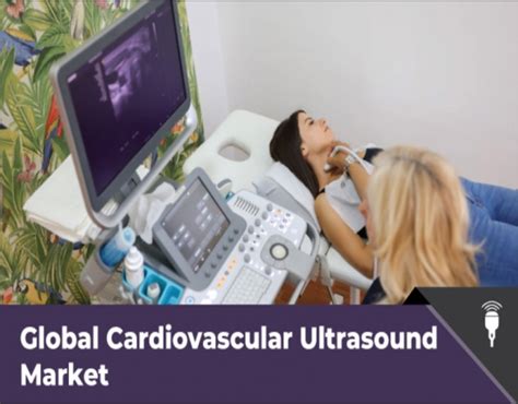 Cardiovascular Ultrasound Market Latest Tech Advancements Live