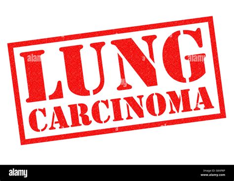 Carcinoma De Pulmón Fotografías E Imágenes De Alta Resolución Alamy