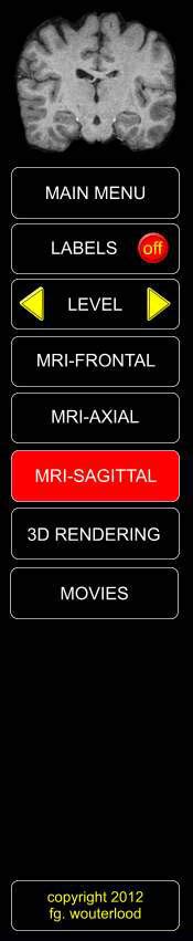 Mri Sagittal Level 03 Labels
