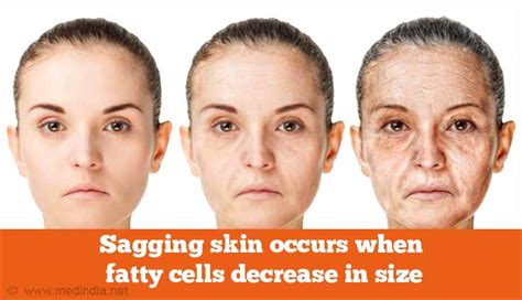 Wrinkles Causes Prevention And Treatment