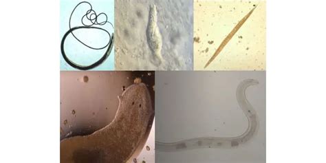 Helminths Parasites