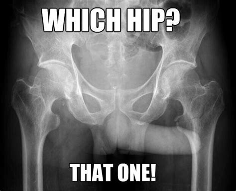 Xray Humor Radiology Humor Yup It Always Points To The Side That Hurts Lol Dezdemon