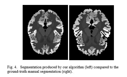 Gallery Deep Learning Brain Age Estimation Hackaday Io