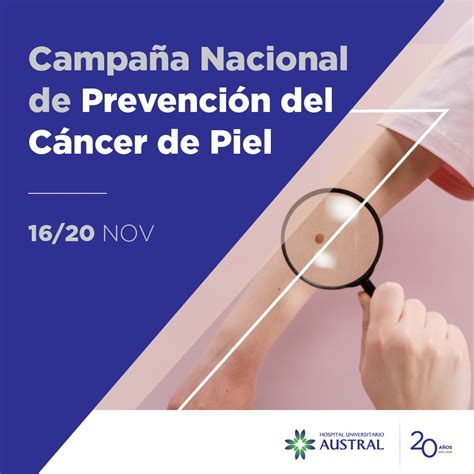 Campaña Nacional De Prevención De Cáncer De Piel Hospital