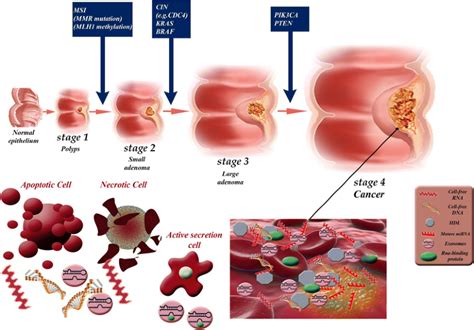 Early Detection Of Colorectal Cancer From Conventional Methods To