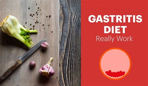 Diet For Gastritis What Can You Eat