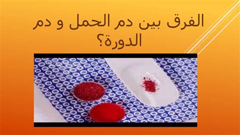 تعاني بعض الفتيات والنساء من ظهور دم بلون بني خلال الدورة الشهرية، ما يثير تساؤلات عديدة لديهن، ويجعل بعض النساء تبحث عن أسباب ذلك، وسط مخاوف من ارتباطها. الفرق بين دم الدورة ودم الحمل , والله من هالاعراض تقدروا ...
