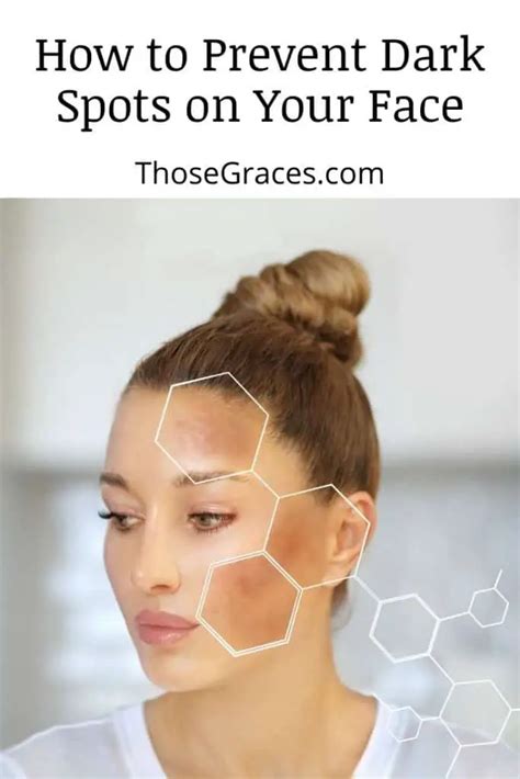 How To Hide Dark Spots On Your Face Without Makeup 9 Tricks