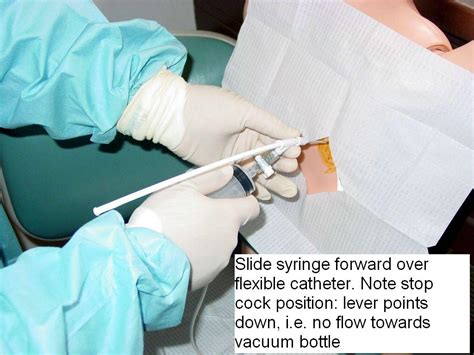 Clinical Notes Thoracentesis A Step By Step Procedure Guide With Photos