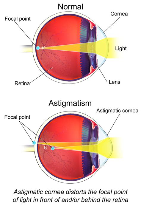 The More You Know Living With Astigmatism When Using Red Dot