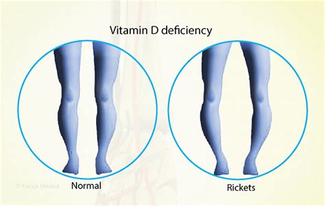 Health Condition Symptoms Causes Treatment And More