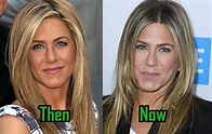 Jennifer Aniston: Plastic Surgery Alters Her Nose! Before-After Photos ...