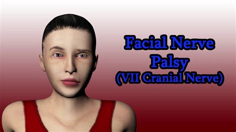 Cranial Nerve Palsy