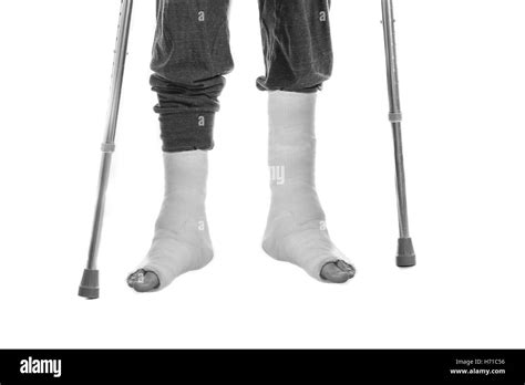 Young Man With Two Broken Ankles And Dual White Casts On His Legs