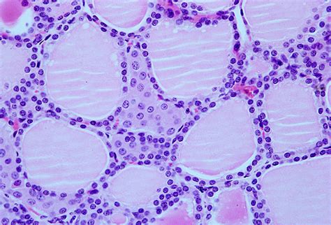Tecido Epitelial Em Tecido Epitelial Histologia Tecidos Biologia Sexiz Pix