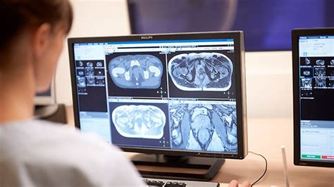 Enhanced Diagnostic Confidence In Imaging Philips