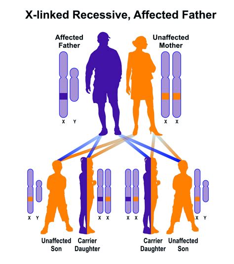 Examine and explain the picture below.what comes to your mind upon seeing it? X-linked recessive, father affected | Hereditary Ocular Diseases