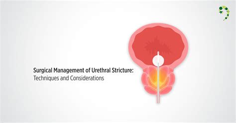Surgical Management Of Urethral Stricture Techniques And Considerations