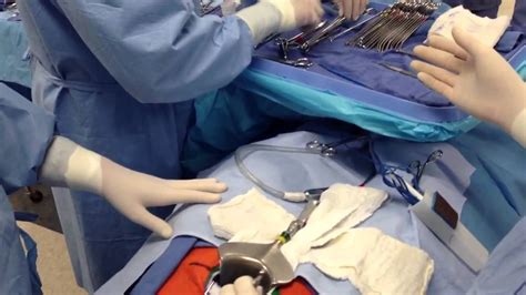 Cesarean Section Surgery Practice Youtube