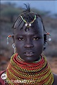 Why do so many black african people have yellow eyes-whites (scleraes ...