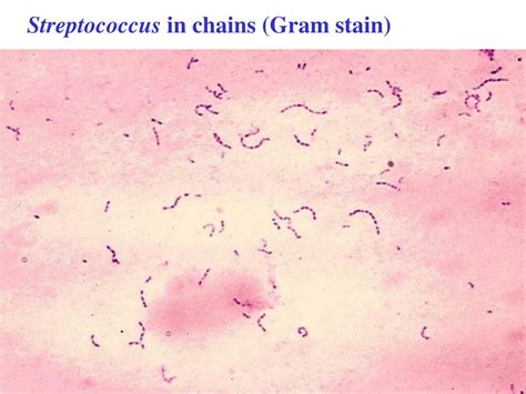 Ppt Streptococci Gram Positive Cocci Lecture 45 Powerpoint