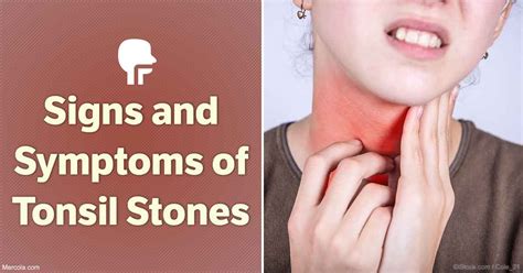 Lingual Tonsil Cancer Symptoms