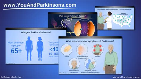 Expert Video Are There Environmental Factors That Cause Parkinsons