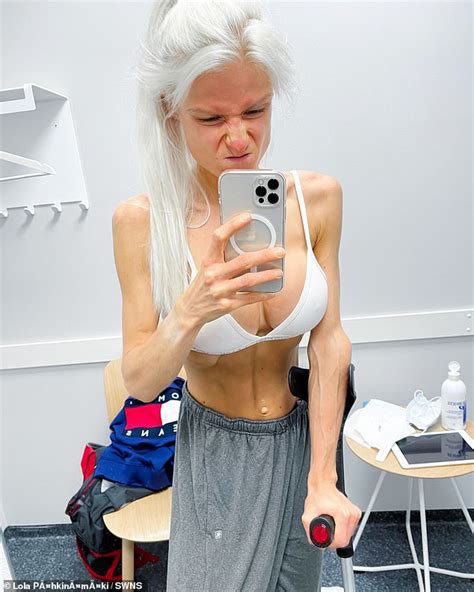 Woman Whose Weight Plummeted To St Lb As She Battled Anorexia Reveals