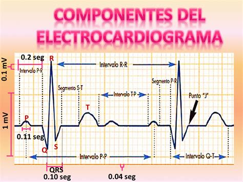 Electrocardiograma Ecg Normal Valores Y Ondas Normales My Xxx Hot Girl