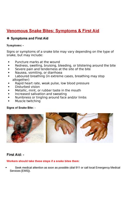 Venomous Snake Bites O Antivenom Is The Treatment For Serious Snake